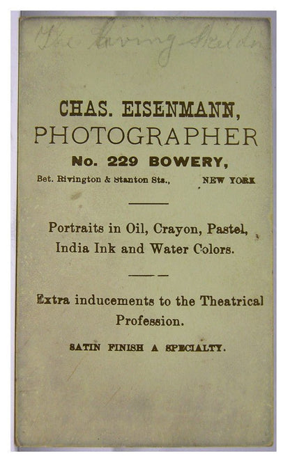 CIRCUS SIDESHOW Cabinet Historical Antique Vintage Type 1 Photo Living Human Skeleton Barnum Baily Isaac W. Sprague 1875