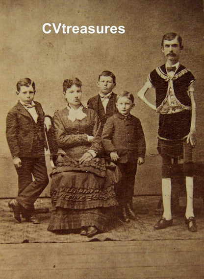 CIRCUS SIDESHOW Cabinet Historical Antique Vintage Type 1 Photo Living Human Skeleton Barnum Baily Isaac W. Sprague 1875